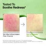 Anua Azelaic Acid 10+ Hyaluron Redness Soothing Serum 30ml - Image 4
