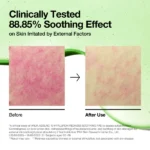 ANUA Azelaic 10 Hyaluron Redness Soothing 90Pads 230ml - Image 4