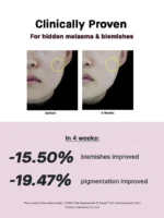 COSRX Niacinamide 15 Serum | Acne & Pore Refining 20ml - Image 3